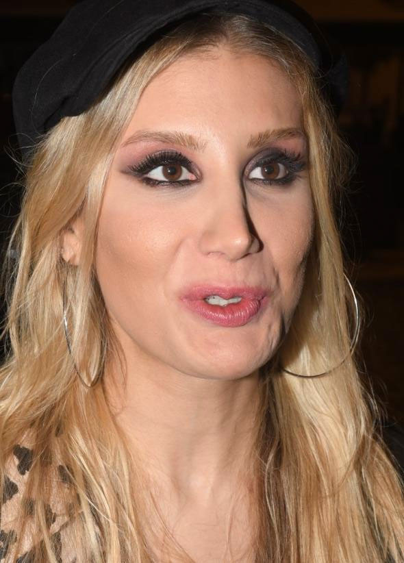 Bana yaklaşmayın yeni botoks yaptırdım! İşte İrem Derici'nin eski ve yeni hali... - Resim: 2