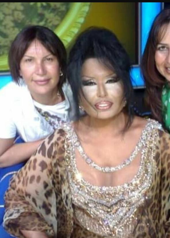 Yok böyle değişim! Bülent Ersoy'a benzemek için 10 ameliyat oldu - Resim: 1