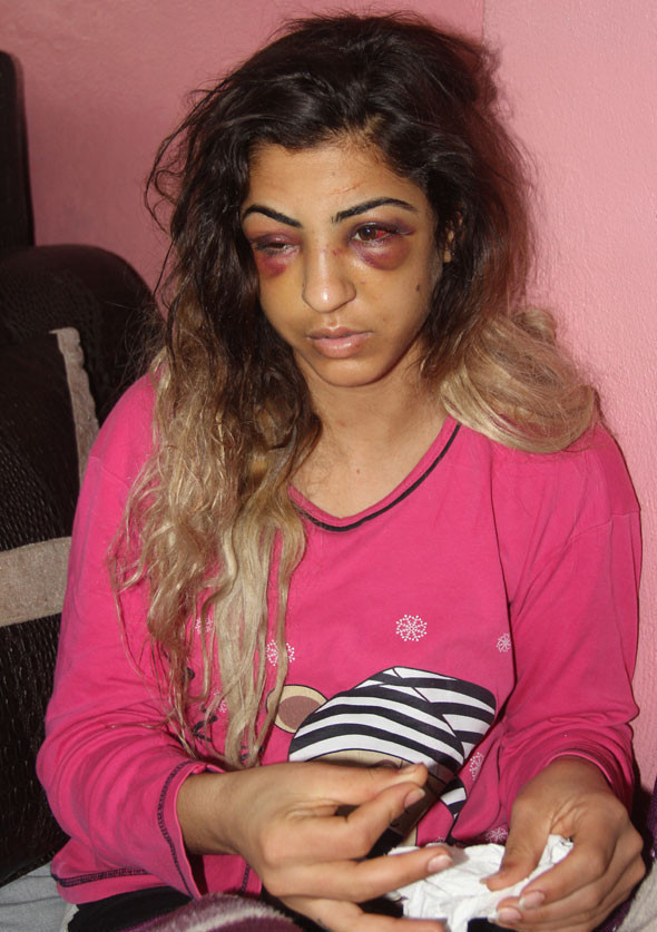 Kuma getirince evi terkeden eşini sokakta yarım saat dövdü - Resim: 4