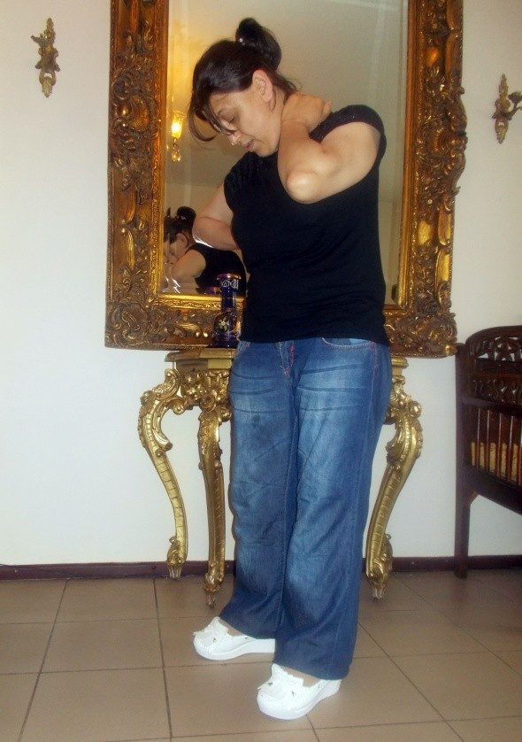 31 yıl sonra fil hastalığını yendi - Resim: 3