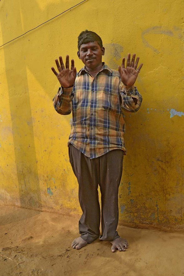 Bu kabilede doğan herkesin 12 parmağı var - Resim: 4