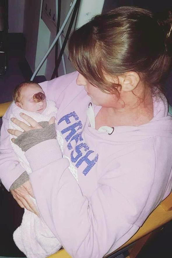 Tüm dünya onu konuştu beyni dışarıda doğdu! - Resim: 1