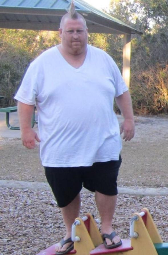 'Yaşayamaz ölürsün' demişlerdi kilo verdi bambaşka biri oldu - Resim: 1