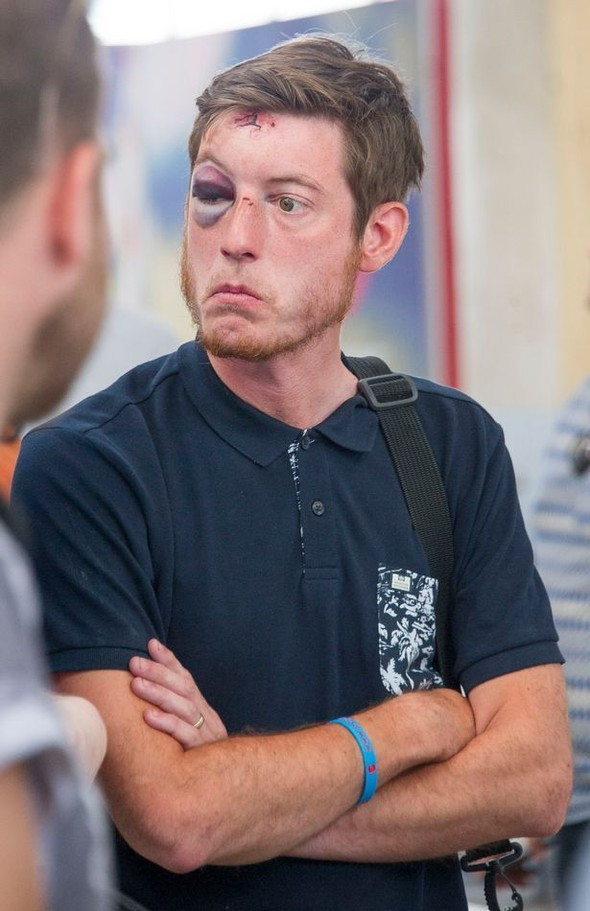 İngiliz taraftar bu hale geldi - Resim: 2