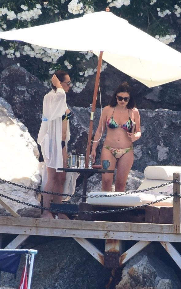 Nurgül Yeşilçay'ın gözündeki morluk - Resim: 1