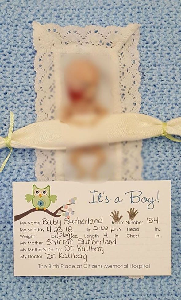 Bebeğini 14 haftalıkken kaybeden anneden inanılmaz hareket... - Resim: 4