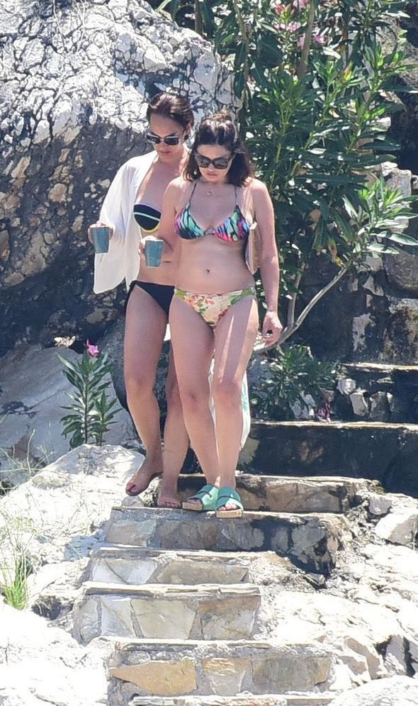 Nurgül Yeşilçay'ın gözündeki morluk - Resim: 3