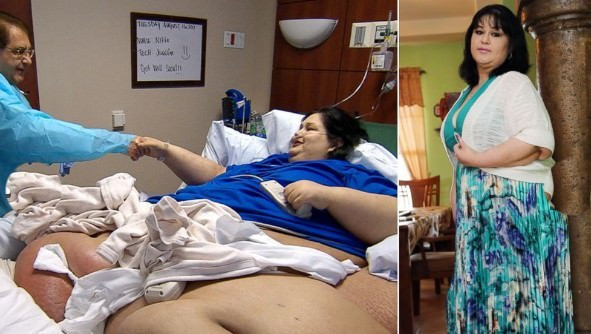 Tam 362 kilo verdi yok böyle değişim - Resim: 4