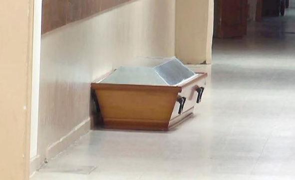 Ölen kardeşinin yüzünü son kez görmek istedi şoka girdi - Resim: 4