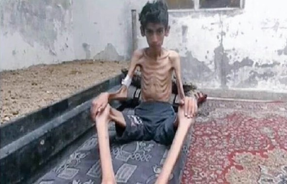 Açlıktan kırılan Medaya'ya yardım gitti - Resim: 2