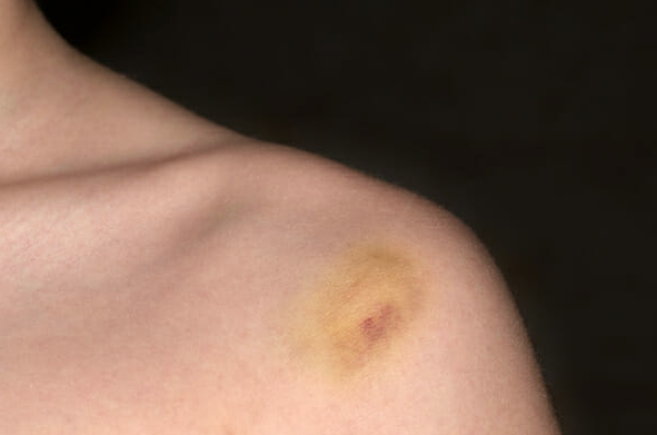 Polisler küçük kızı bu halde buldu meğerse hem annesi hem babası... - Resim: 2