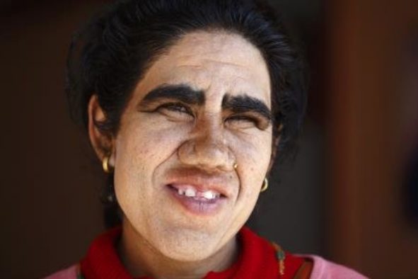 Onlar sizin bildiklerinizden çok farklı tüm aile bu halde - Resim: 2