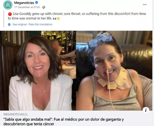 Bademcik iltihabı zannetti hayatının şokunu yaşadı! 3 çocuk annesi şimdi içler acısı halde - Resim: 0