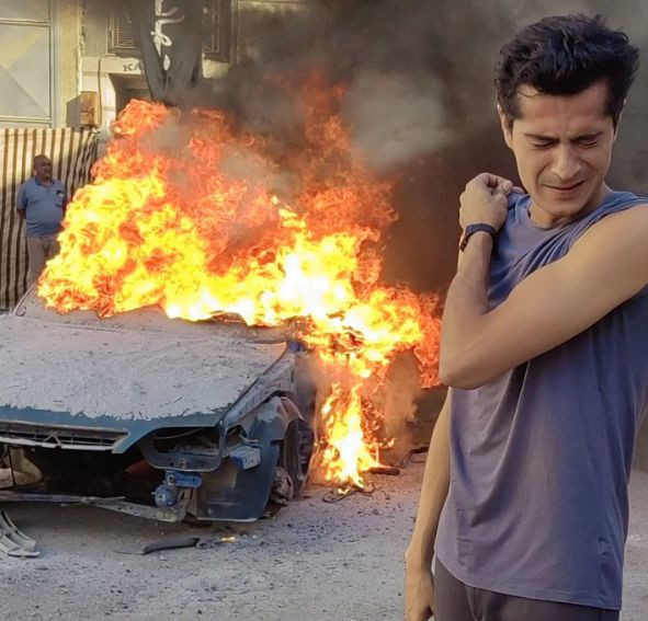 Sette çıkan korkunç kaza oyuncuyu yaraladı! Fünye İsmail Hacıoğlu'nun yüzüne patladı! - Resim: 1