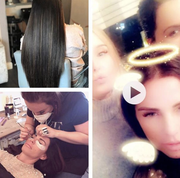 Yara bere içinde! Katie Price'ın yüzü tanınmaz hale geldi - Resim: 1