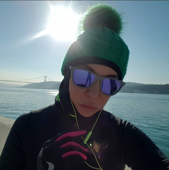 Deniz Akkaya'nın estetiksiz haline bakın tanımak imkansız - Resim: 2