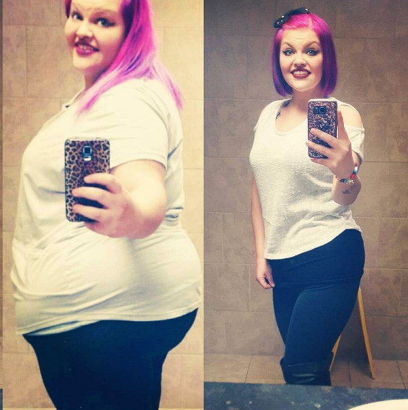 Her zayıflama hikayesi mutlu sonla bitmiyor inanılmaz! - Resim: 3