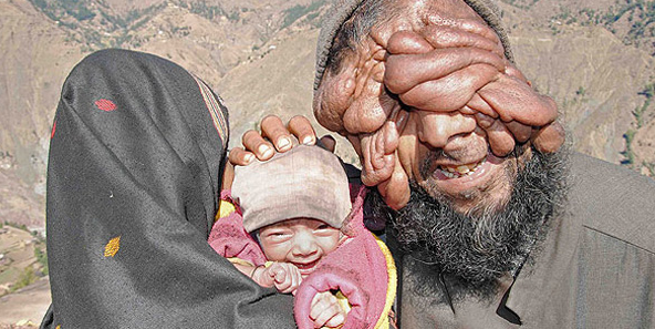 Yüzü olmayan adamın mucize bebeği - Resim: 3