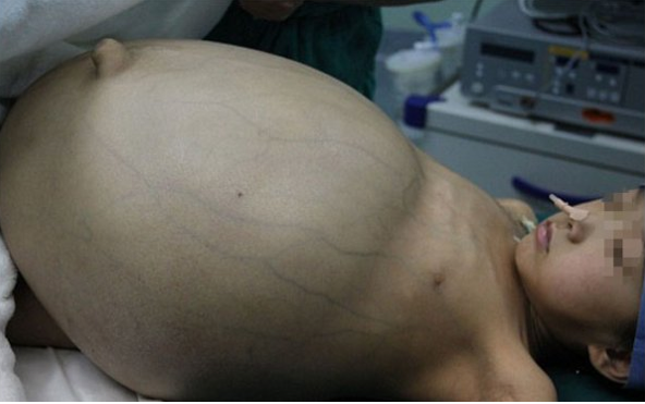 Küçük kızın bu halini gören şok oldu! - Resim: 2