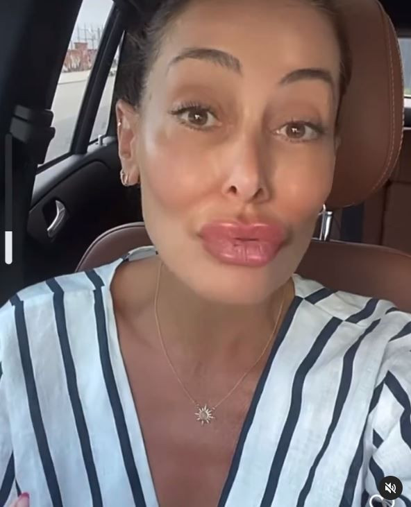 Melek Baykal'dan estetik ve dolgu dudak videosu! Serap Paköz çok kızacak! - Resim: 3