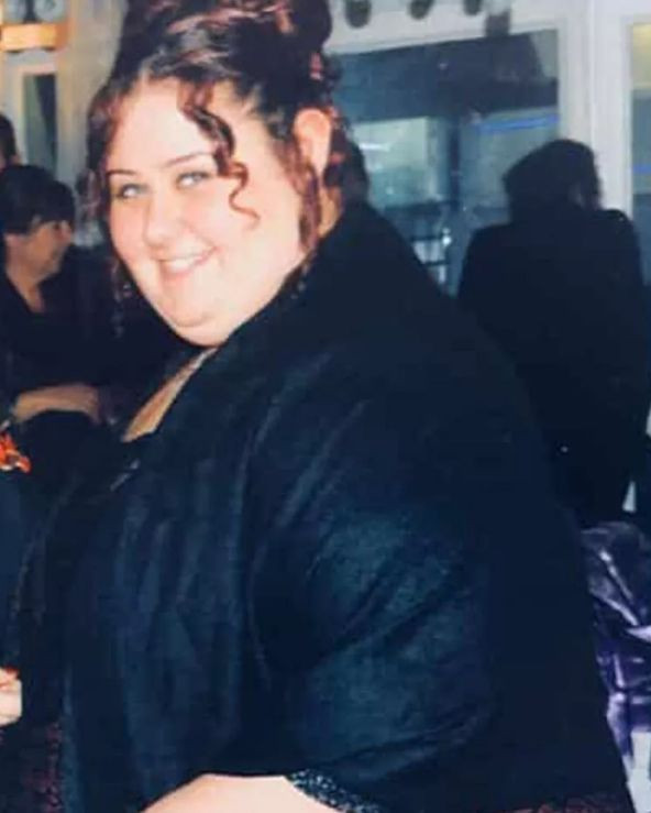 Mide ameliyatı sonrası 100 kilo veren Aslı Samat: Şişman bir kıza... - Resim: 3