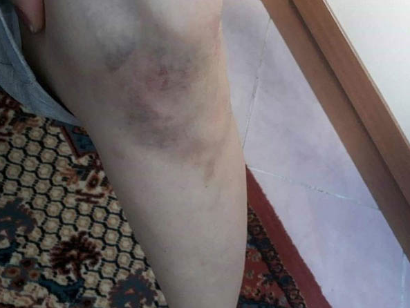 Evin kapısını kırıp banyoda kabusu yaşattı!  - Resim: 4