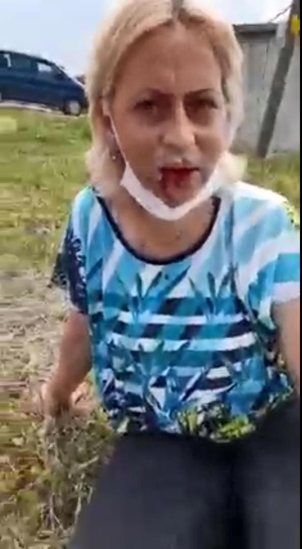 Eskişehir'de 'tek suçum' deyip isyan etti! Köpek beslerken canını zor kurtardı - Resim: 3