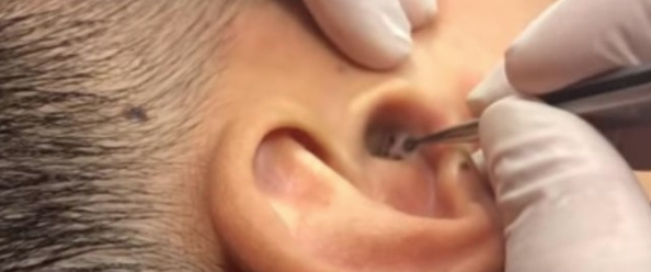 Midesi olan bakabiliyor kulağından çıkan şey tam 4 başlı... - Resim: 2