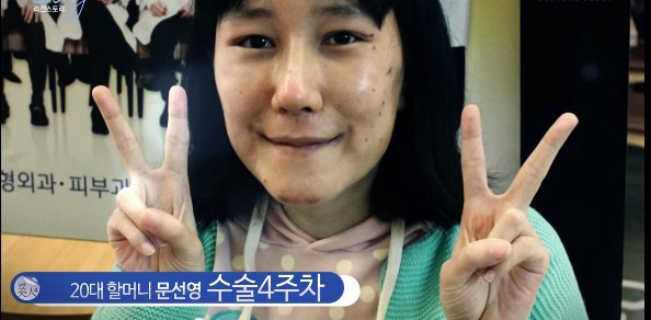 Koreli kadının estetik mucizesi - Resim: 3