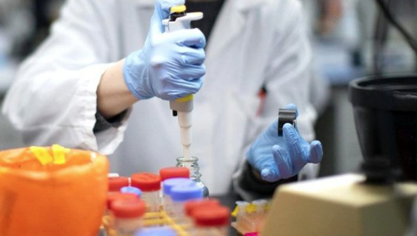 Koronavirüs dünyayı sardı! İtalya'da 46 doktor öldü, insandan kediye virüs bulaştı - Resim: 3