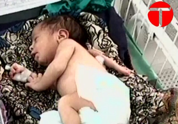 Aman Allah'ım! Şimdi de üç kollu bebek - Resim: 4