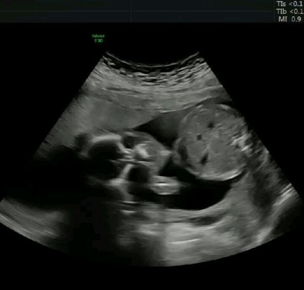 Hastaneye yetişemedi çareyi arabada doğum yapmakta buldu - Resim: 1