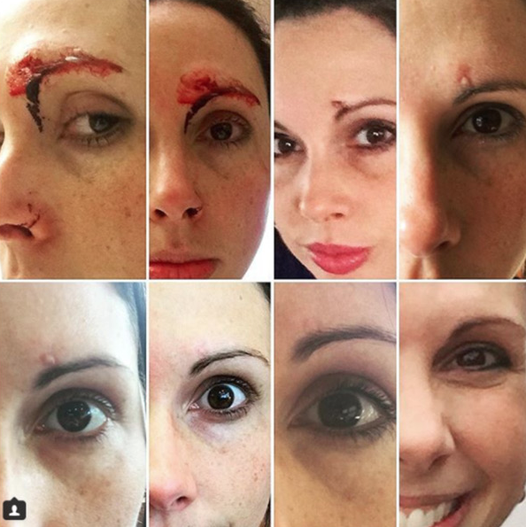 Ormanda spor yapan kadına saldırdı sonrası çok fena! - Resim: 4