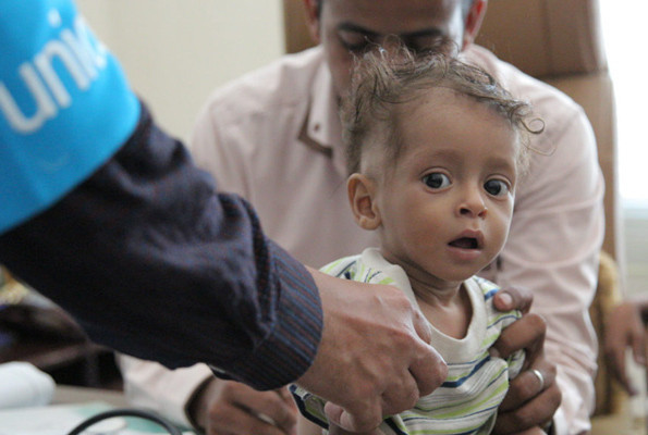 85 bin bebek açlıktan hayatını kaybetti Yemen kan ağlıyor - Resim: 2