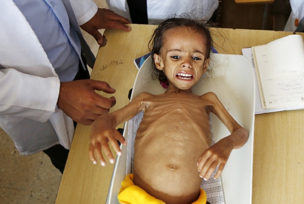 85 bin bebek açlıktan hayatını kaybetti Yemen kan ağlıyor - Resim: 4