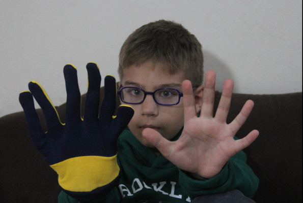 Adana'da yaşıyor 9 yaşındaki Demirhan'ın tam 24 parmağı bulunuyor - Resim: 3