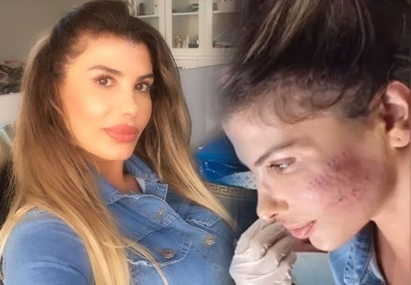 Şarkıcı Hatice'nin yüzü yandı son halini görenler tanımakta güçlük çekti - Resim: 3