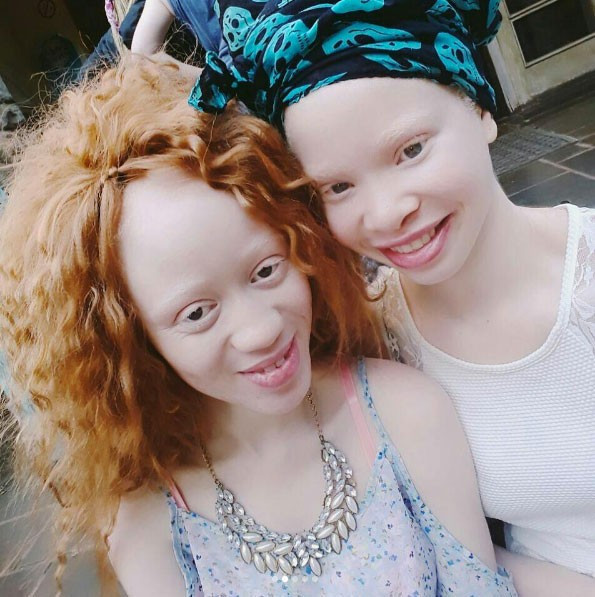 Dış görünüşü korkuttu herkes onunla dalga geçti ama... - Resim: 3