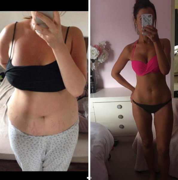 Böyle değişim görülmedi! İğne ipliğe döndü resmen - Resim: 1