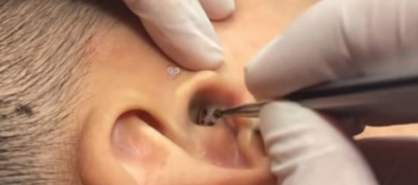 Midesi olan bakabiliyor kulağından çıkan şey tam 4 başlı... - Resim: 4