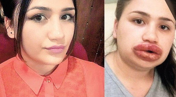 Silikon faciasında yeni gelişme o hemşire yarın... - Resim: 4