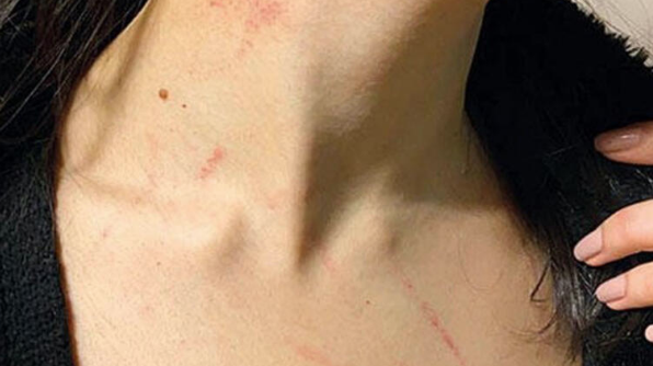 İstanbul'da lüks otelde taciz dehşeti: Odaya sürükledi kapıyı kapattı - Resim: 1