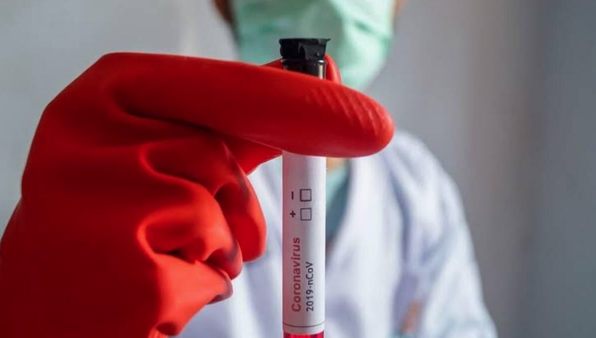 Prof. Dr. Mehmet Öz açıkladı! İki tip koronavirüs var birincisi çok daha tehlikeli - Resim: 3