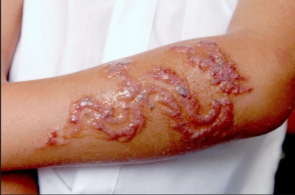 Sizin de başınıza gelebilir! - Resim: 4