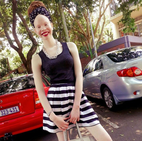 Dış görünüşü korkuttu herkes onunla dalga geçti ama... - Resim: 2