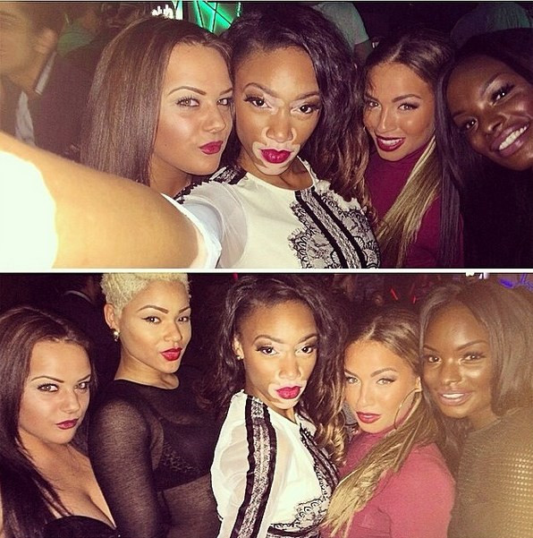 Vitiligo hastası genç kız manken oldu - Resim: 2