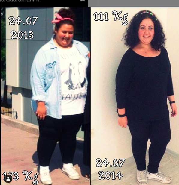 Aslı Samat kimdir eski hali nasıldı 93 kilo verdi - Resim: 0