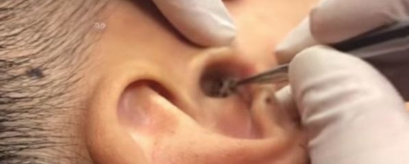 Midesi olan bakabiliyor kulağından çıkan şey tam 4 başlı... - Resim: 3