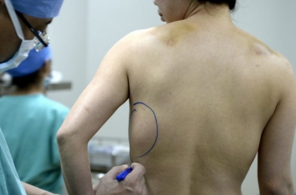 Silikon yaptırdığına yaptıracağına bin pişman oldu - Resim: 2