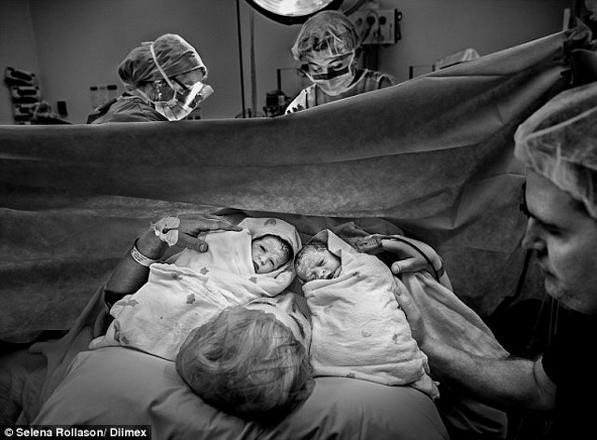 Hamileyken hamile kaldı sadece 10 kişide oluyor - Resim: 4